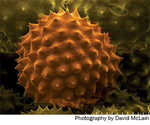 Ragweed pollen under the microscope. Photograph by David McLain.