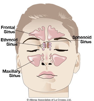 sinus-cavity-illustration-copyrighted