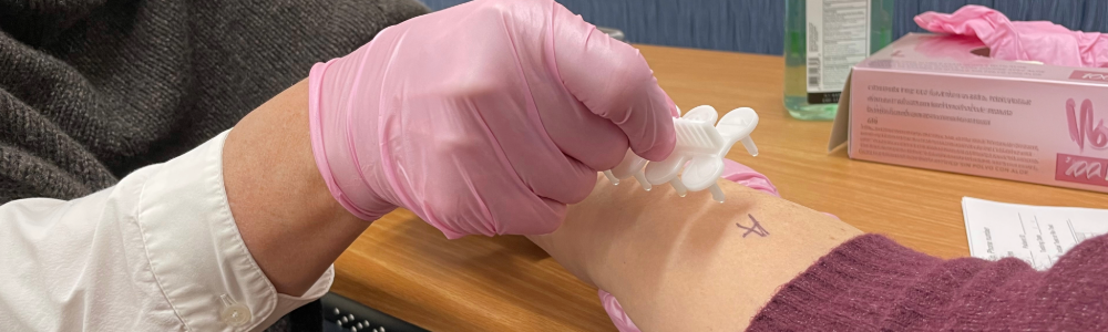 skin test allergy diagnosis