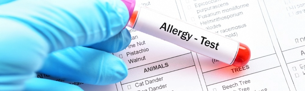 blood test allergy diagnosis